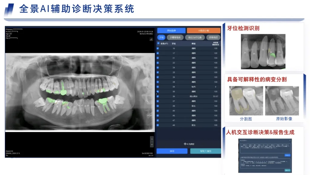 华西口腔AI辅助诊断系统